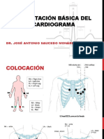 Interpretación Básica Del Electrocardiograma