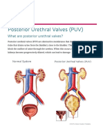 Posterior Urethral Valves (PUV) - Children's Hospital of Philadelphia