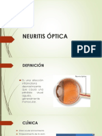 Neuritis Optica