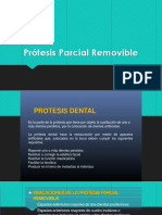 Protesis Parcial Removible