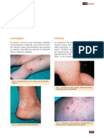 Prurito PEDIATRICO PDF