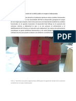 Kinesiotaping en La Disfunción de La Sínfisis Púbica en Mujeres Embarazadas