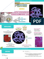 Infecciones X Neumococo