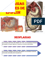 Anestesia en Hipertension Arterial Sistemica