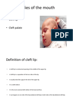 Cleft Lip & Palate