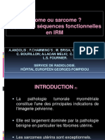 Fibrome Versus Sarcome IRM