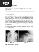 Caso Clínico Fractura Tallo Verde