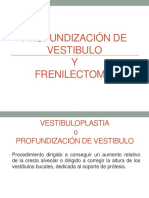 Vestibuloplastia y Frenectomia