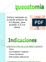 TRAQUEOSTOMÍA