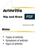 Hip and Knee Arthritis