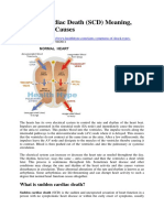 Sudden Cardiac Death