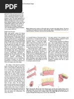 Been Abandoned in Favor of Hetero-/ortho-Topic Pouches.: Heterotopic Continent Diversion