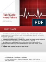 Left Sided & Right Sided Heart Failure