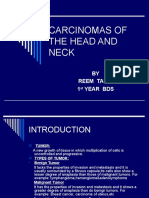 Carcinoma of The Head and Neck New 1