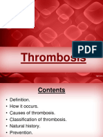 Thrombosis 161111041212