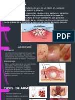 ABSCESOS