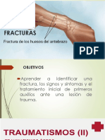 Fracturas PDF