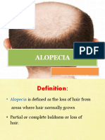 Alopecia 160716052003