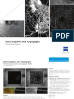 ZEISS AngioPlex Case Reports US 31 150 0032I