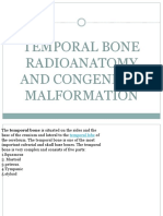 Temporal Bone Radioantomy