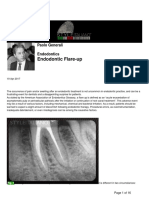 Paolo Generali Endodontic Flare Up