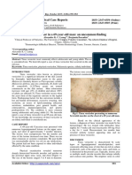 Tinea Versicolor PDF