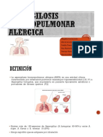 Aspergilosis Broncopulmonar Alérgica