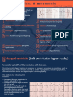 STEMI Mimics A Mnemonic.
