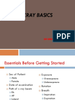 Chest Xray Basics: DR Umamahesh MD, FCCP