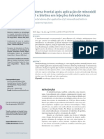 v9 Edema Frontal Apos Aplicacao de Minoxidil 5 e Biotina em Injecoes Intradermicas