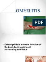 Osteomyelitis 171228103819