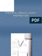 PFM Crown Preparation 