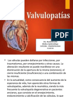 Clase de Valvulopatias