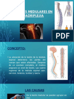 Lesiones Medulares en Cuadriplejia