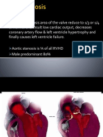 Aortic Stenosis