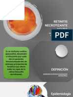 Retinitis Necrotizante Aguda