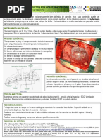 Bullectomia