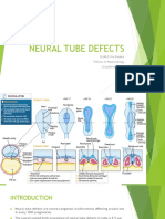 Neural Tube Defects: Dr.M.G.Kartheeka Fellow in Neonatology Cloudnine, OAR