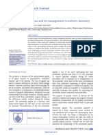 Black Triangle Dilemma and Its Management in Esthetic Dentistry