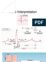 ECG Interpretation