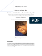 Posterior Auricular Mass: Interesting Case Series