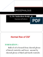 Hydrocephalous: by Dr. Sudarshan Reddy - K