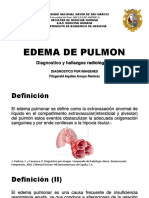 Edema de Pulmon