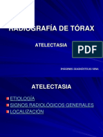 Radiografia Torax Signos