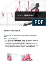 Cardiac Arrhythmia: Prepared By: Charina Gail O. Baloy, RPH, Msc. (C.)