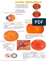 Retinopatía Diabética