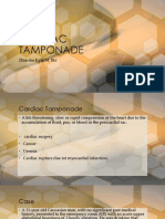 Cardiac Tamponade: Zhiarina Kyla M. Biz