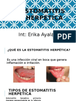 Estomatitis Herpética Final