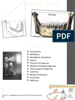 Hinge Axis Theories