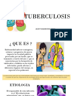 Tuberculosis